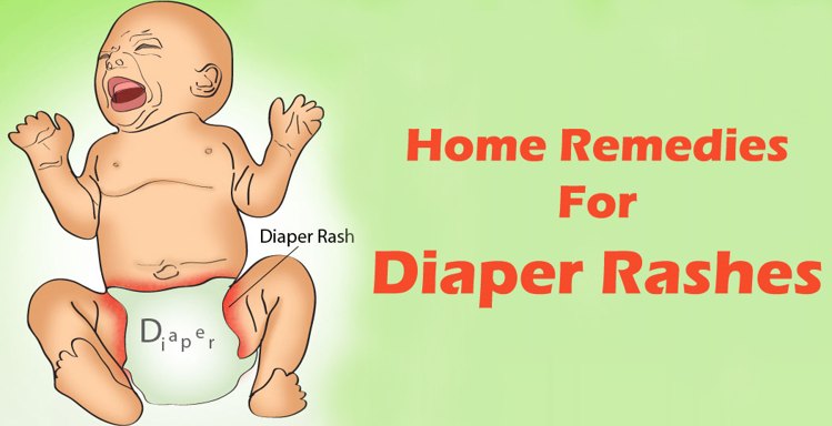 डायपर रैशेज से बचाव - prevention from diaper rash in hindi